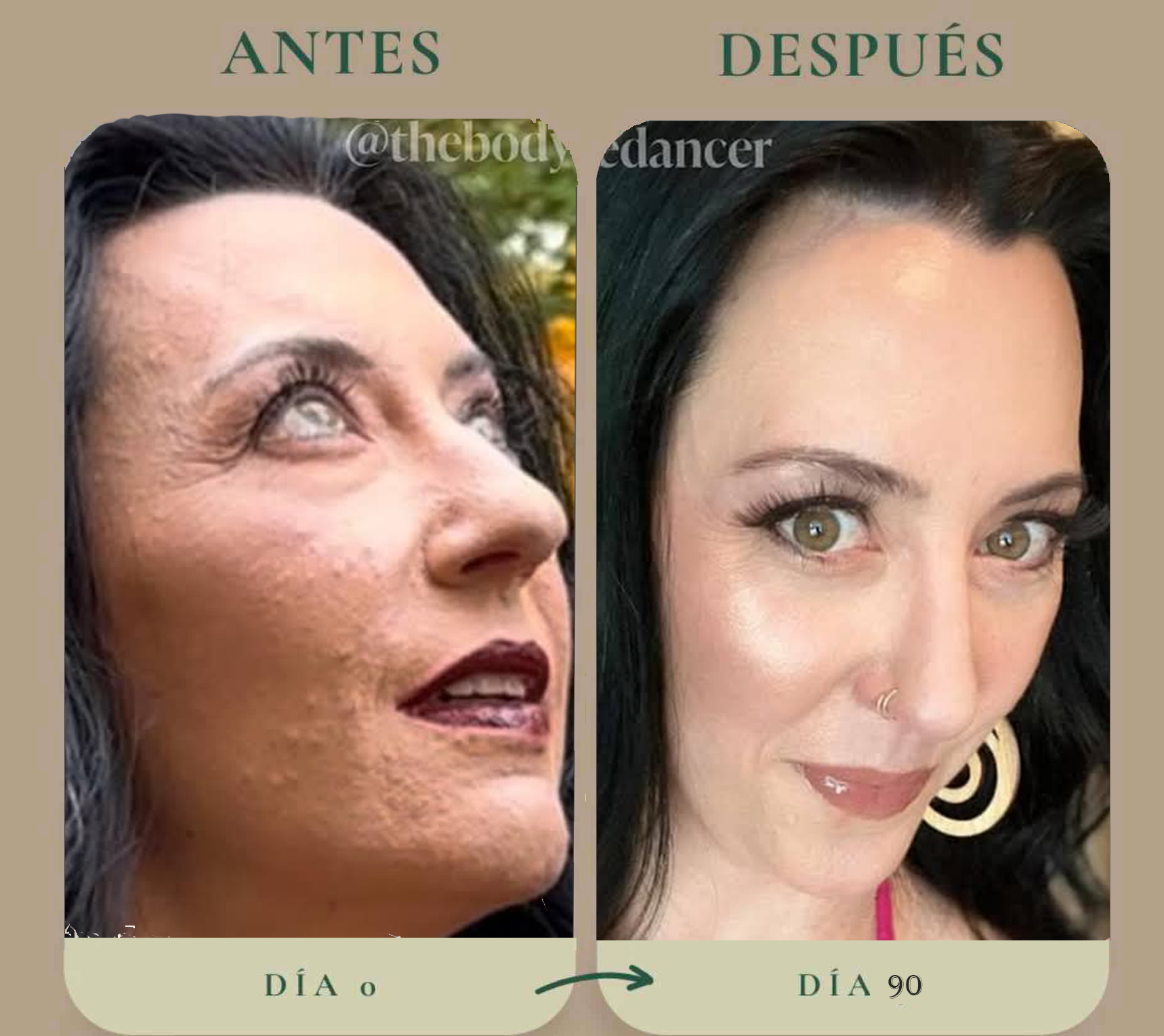 Antes y después — caso 2