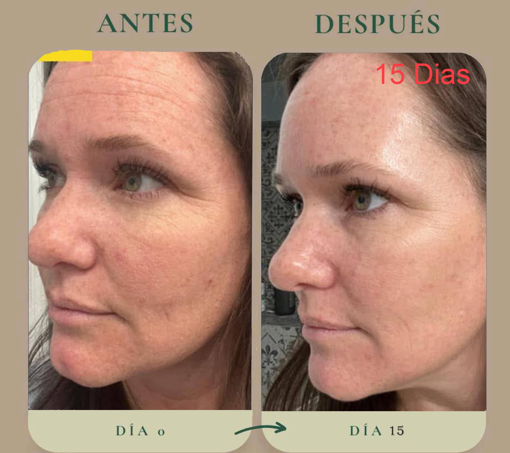 Antes y después — caso 6